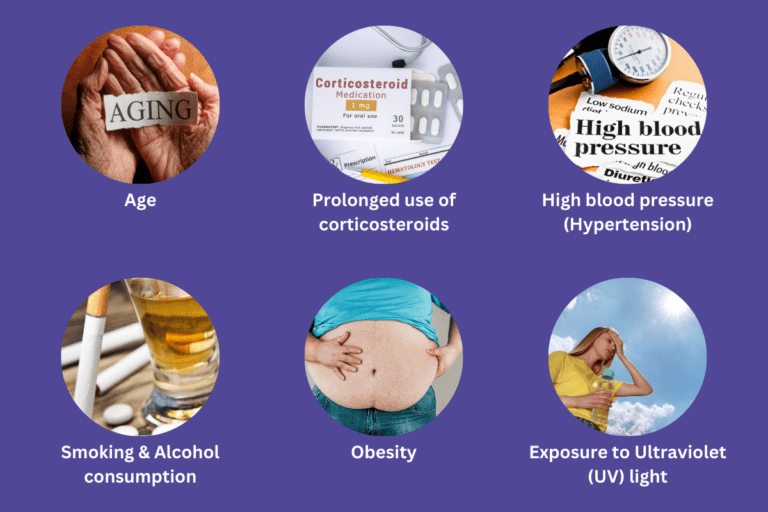 Risks of cataracts in diabetic patients