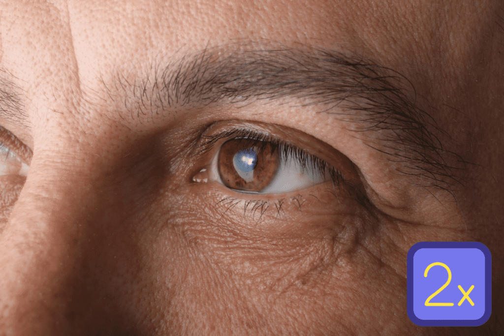 Can cataract surgery be done twice to the same eye