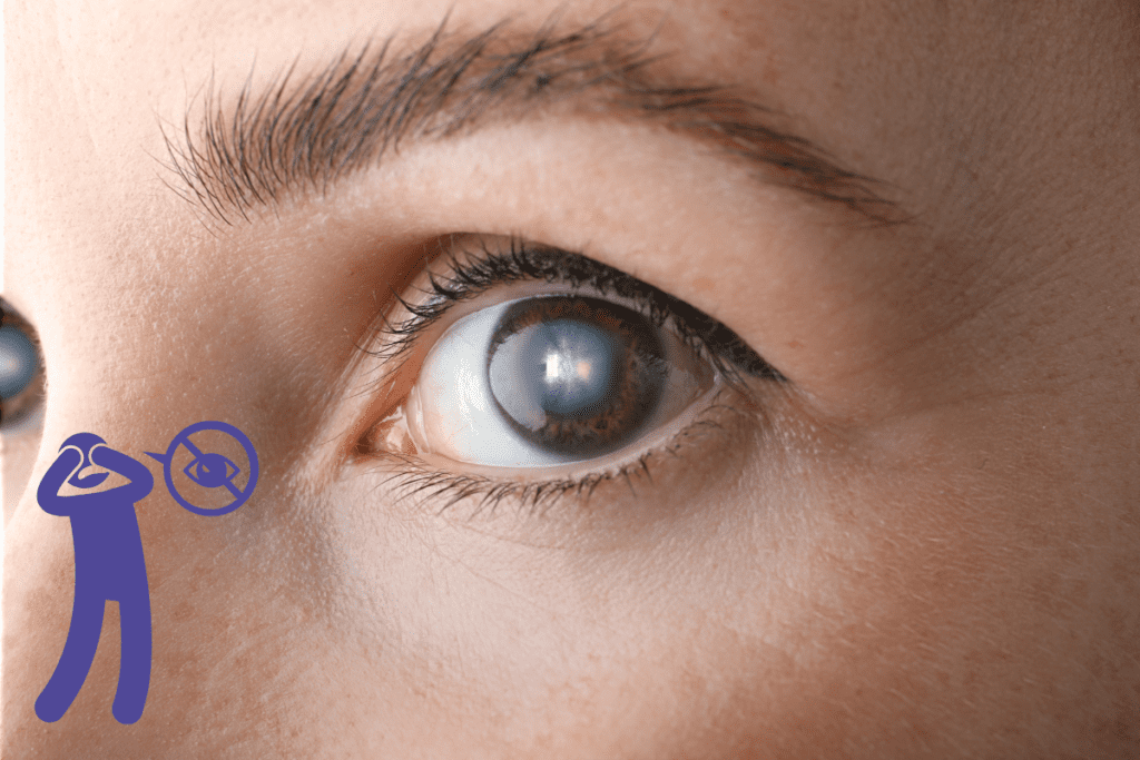 Can cataracts cause blindness