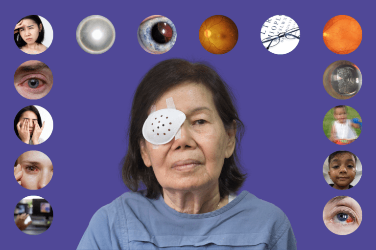 What are the most common problems after cataract surgery?