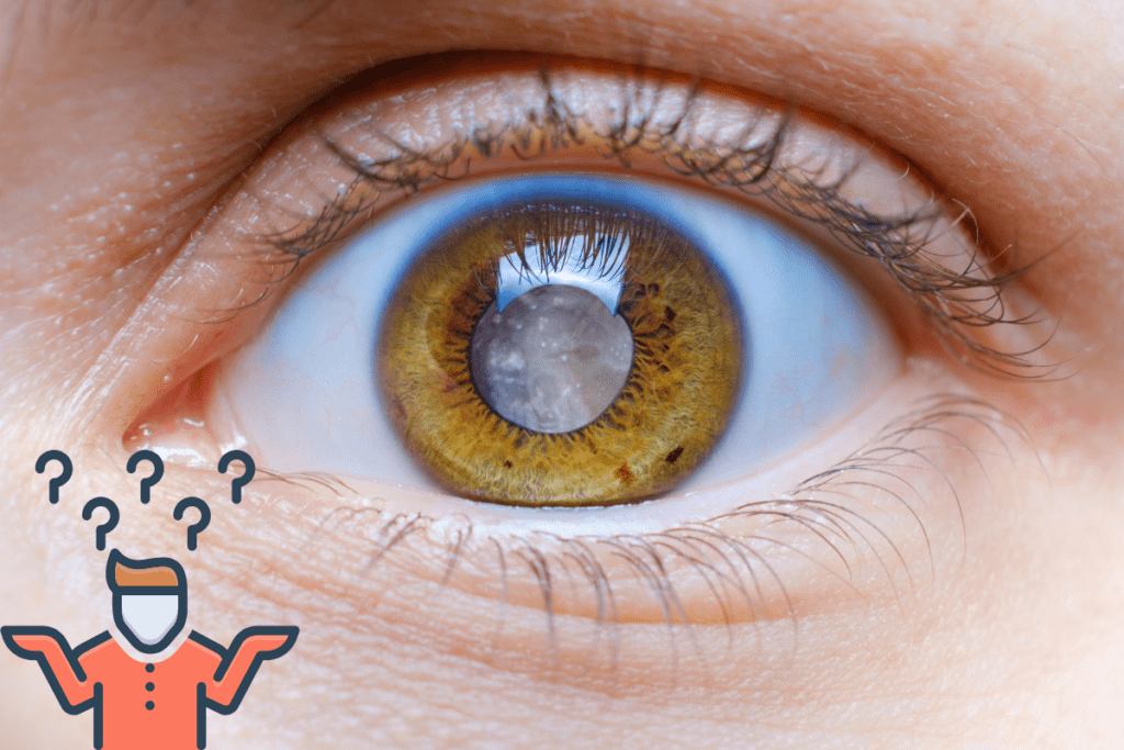 What will happen if a cataract is left untreated