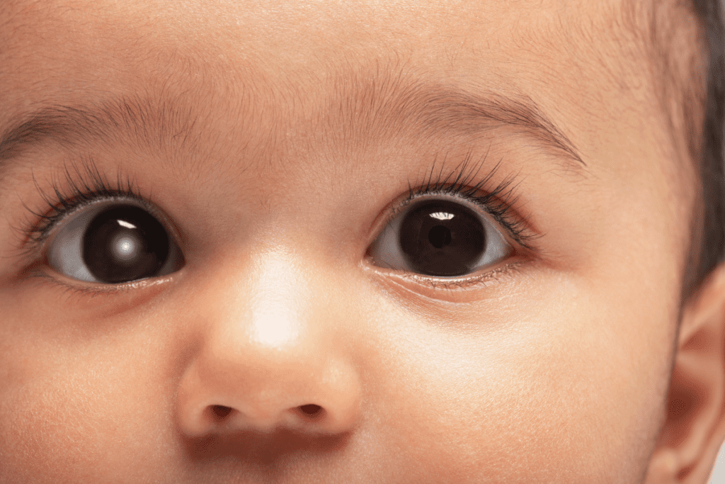 Pediatric cataract surgery Everything parents need to know