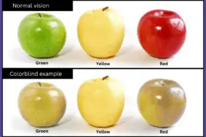 Color blindness