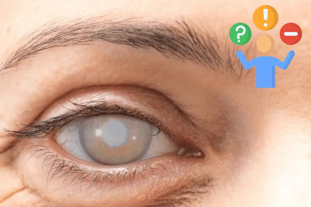 Complications of cataract