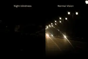 Night blindness