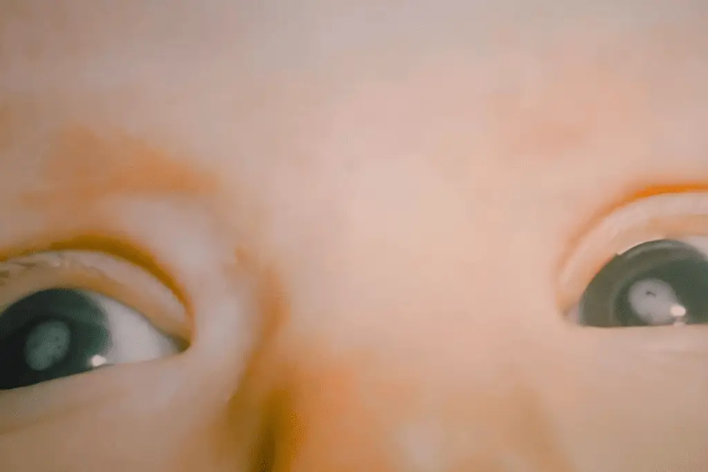 Congenital cataracts