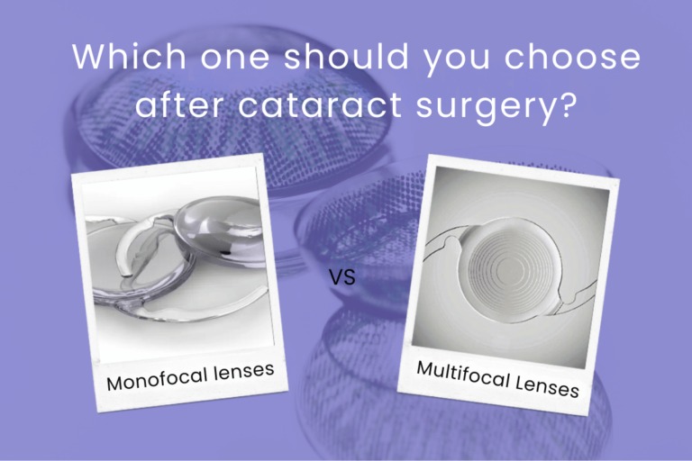 Monofocal vs Multifocal lenses