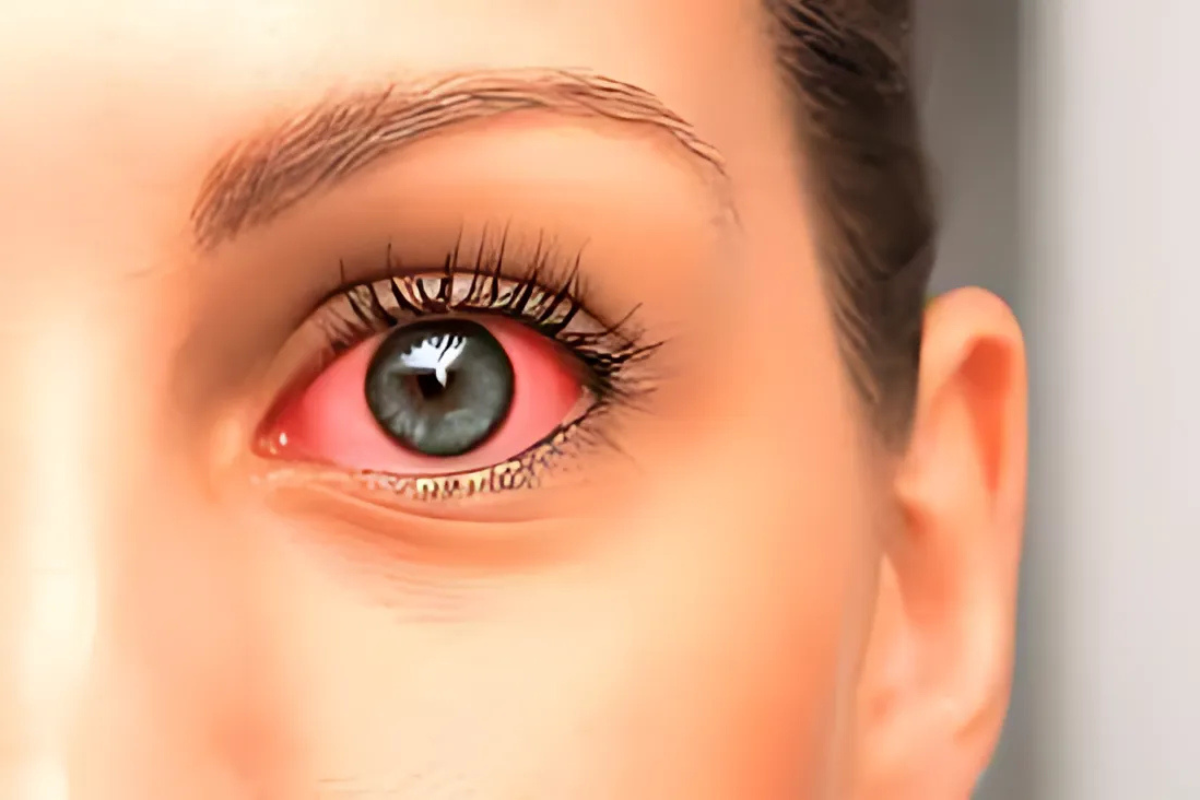 Different types of glaucoma procedures