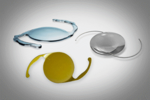 Choosing the right lens for cataract surgery: A complete guide