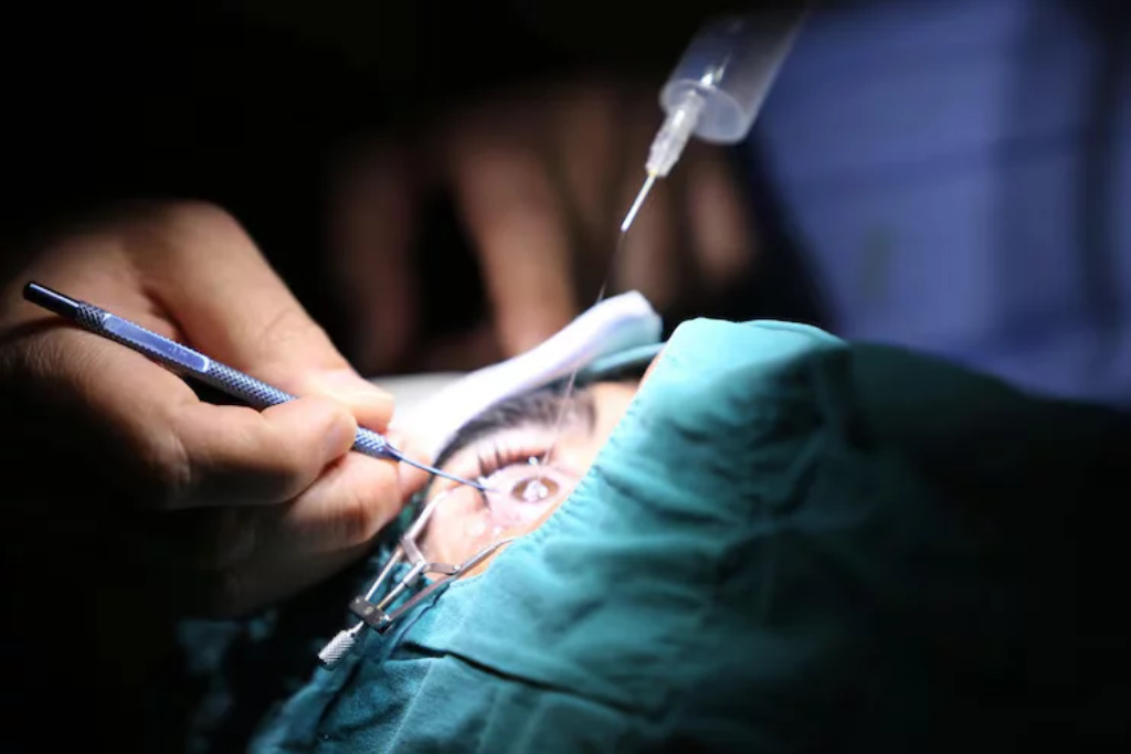 MICS cataract surgery – Procedure, Benefits, Cost & Recovery